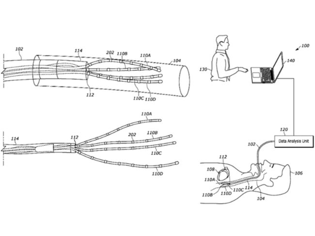 system for esophageal protection during ablation